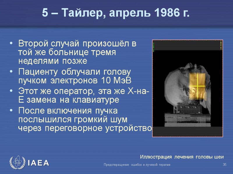 Предотвращение ошибок в лучевой терапии  35 5 – Тайлер, апрель 1986 г. Второй